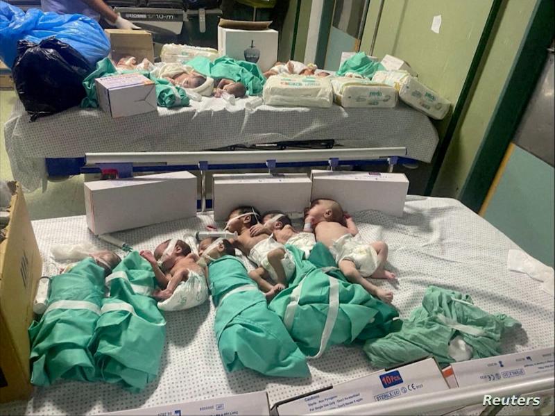 خدج في مستشفى الشفاء خدج في مستشفى الشفاء