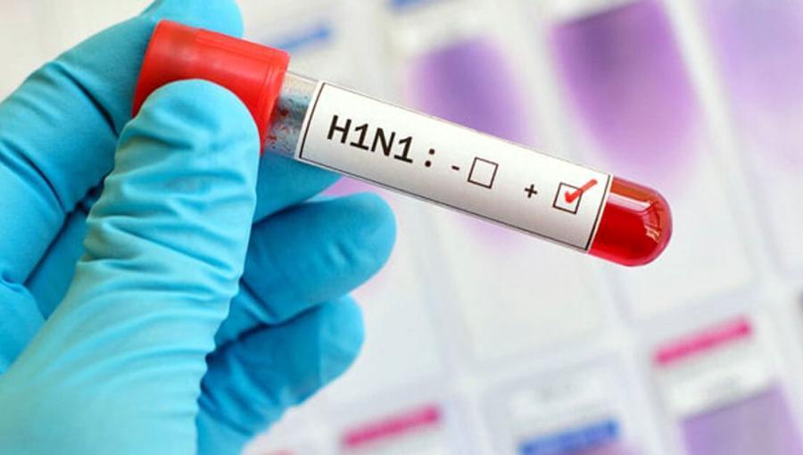عينة فحص لإنفلونزا الخنازير H1N1 عينة فحص لإنفلونزا الخنازير H1N1 | تعبيرية