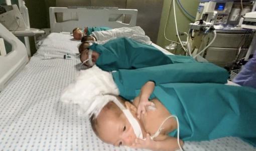 تجميع الخدج على سرير واحد في مجمع الشفاء الطبي بعد انقطاع الأكسجين في الحضانات