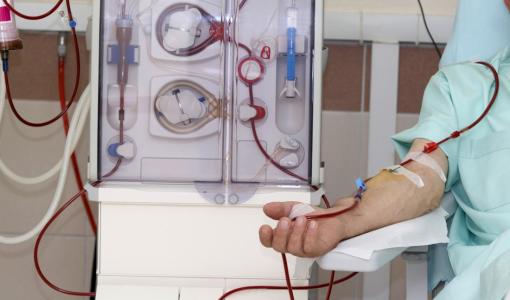 شخص خلال جلسة غسيل كلى