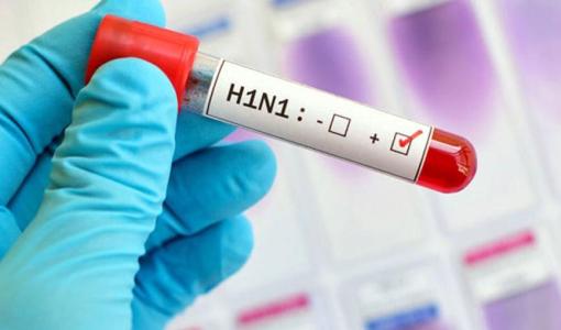 عينة فحص لإنفلونزا الخنازير H1N1 | تعبيرية