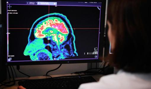 اختصاصية تقرأ نتيجة فحص تصويري للدماغ | تعبيرية