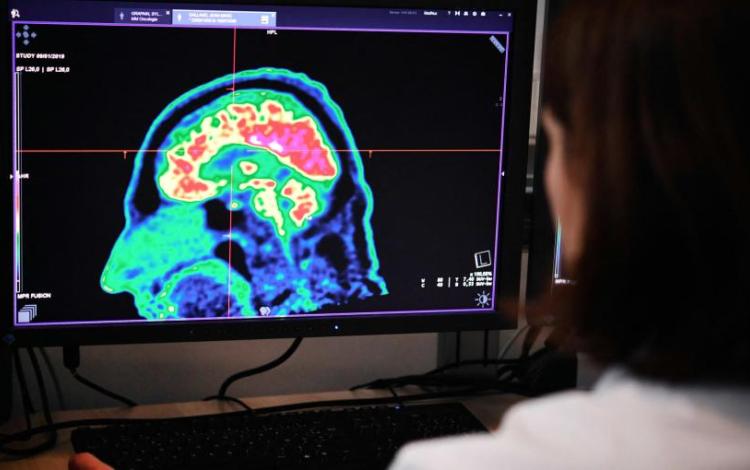 اختصاصية تقرأ نتيجة فحص تصويري للدماغ | تعبيرية